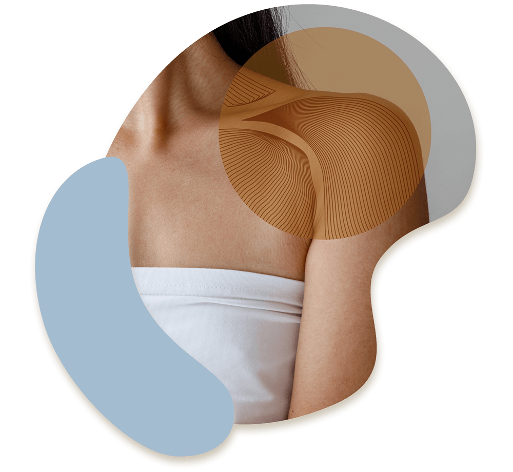 Woman's shoulder with illustrated structural view